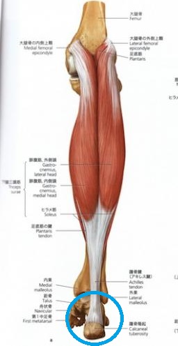 磐田市で踵の痛みでお悩みのミニバス選手へ アーチフィジカルケアグループ