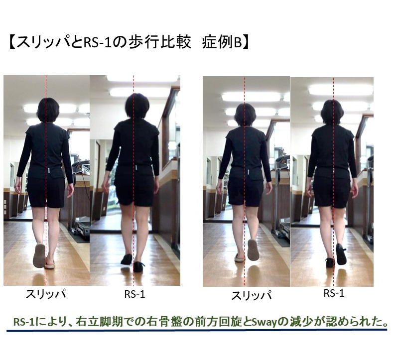 スリッパとオリジナルルームシューズの差を比較検証 歩行と姿勢の分析を活用した治療家のための専門サイト 医療従事者運営