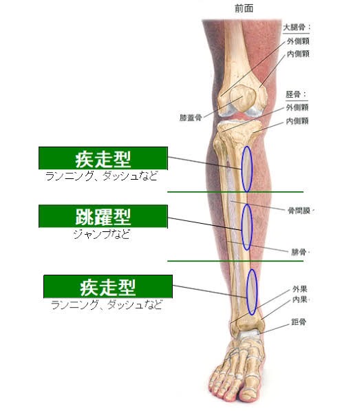 すね内側の痛みの繰り返しでお悩みの方（スポーツラボ鍼接骨院 沖縄  